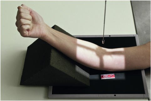 Fig. 4.125 AP cot (parțial flectat); humerus paralel cu receptorul de imagine.