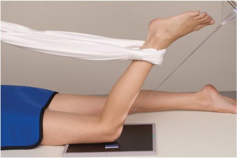 Fig. 6.139 Metoda Hughston — flexia la 50° până la 60°.