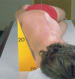 Fig. 8.87 oblic anterior