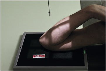 Fig. 4.129 pentru humerusul distal — raza centrală perpendiculară pe humerus.