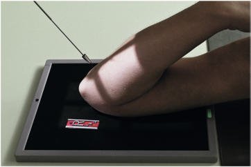 Fig. 4.130 pentru antebrațul proximal — raza centrală perpendiculară pe antebraț.