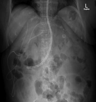 Fig. 3.30 Abdomen superior AP—orientare orizontală. (Din Abdulhassan Al