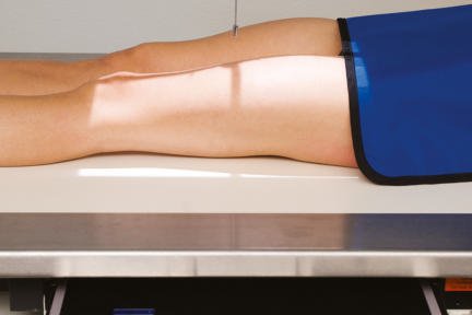 Fig. 7.36 AP — femurul mijlociu și distal (capul la extremitatea catodică).