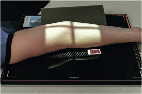 Fig. 4.135 oblic lateral (extern) la 45°.