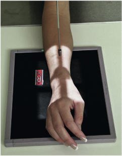 Fig. 4.91 PA oblică a pumnului (articulației radiocarpiene) fără suport.