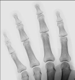 Fig. 4.84 AP axială. (după Wilson DJ et al.: Musculoskeletal imaging,