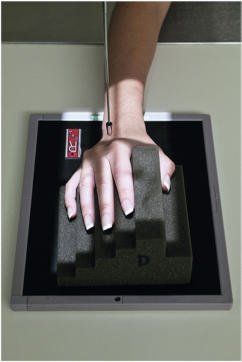 Fig. 4.70 Mână, incidență oblică de rutină