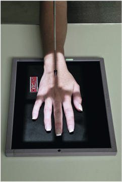 Fig. 4.67 Mână, incidență PA, raza centrală la a treia articulație metacarpofalangiană (MCP 3).