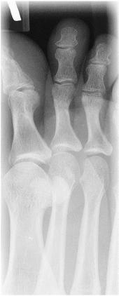 Fig. 6.46 oblică medială —