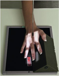 Fig. 4.41 A treia falangă (laterală