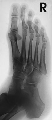 Fig. 6.62 medial la 40°