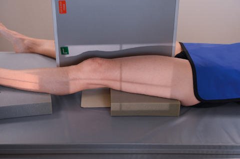Fig. 7.39 Incidență lateromedială pentru traumatism acut / în regim de urgență (fascicul orizontal).