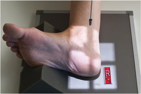 Fig. 6.75 Calcaneu în incidență mediolaterală.