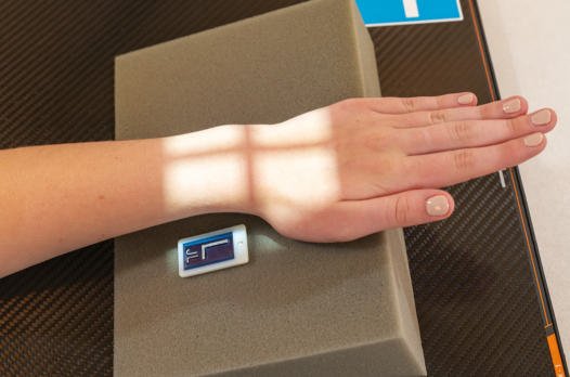 Fig. 4.102 PA a pumnului pentru scafoid, după cum urmează: mâna ridicată la 20°; ulnar