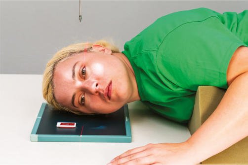 Fig. 11.138 Oase proprii nazale (OPN), profil drept — decubit semipron și