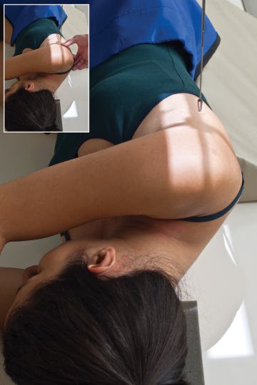 Fig. 5.106 Poziția omoplatului (scapulei) în decubit lateral. Imaginea inserată prezintă palparea