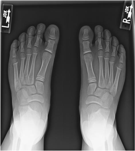 Fig. 6.68 AP în încărcare —