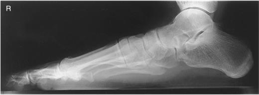 Fig. 6.71 În încărcare — [fragment deteriorat în sursă]