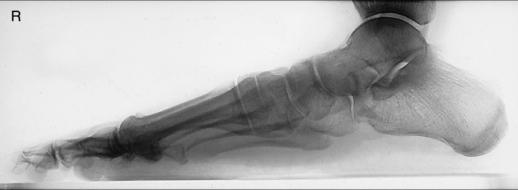 Fig. 6.69 profil în încărcare — [fragment deteriorat în sursă]