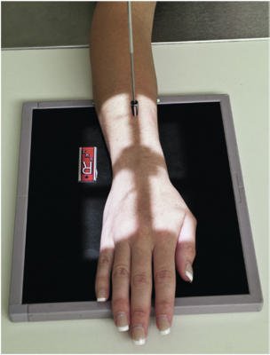 Fig. 4.86 Pumn (Articulație Radiocarpiană) PA.