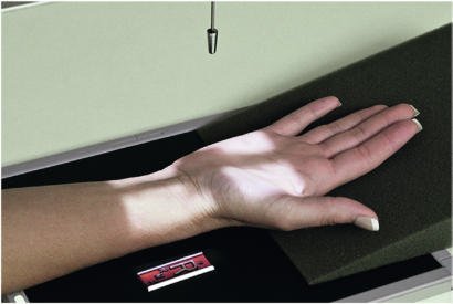 Fig. 4.87 Pumn (Articulație Radiocarpiană) AP alternativă.