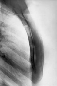 Fig. 10.25 profil, stern.