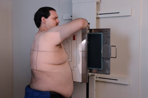 Fig. 2.73 Poziție oblică anterioară dreaptă (OAD / RAO) la 45°.
