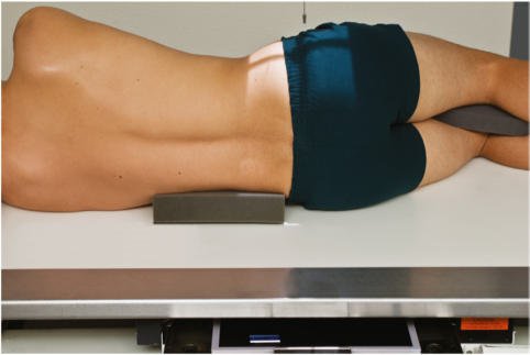 Fig. 9.71 sacru și coccis lateral.