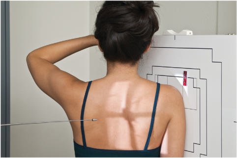 Fig. 5.77 Incidență PA oblică (profil lateral în Y scapular), cu raza centrală perpendiculară.
