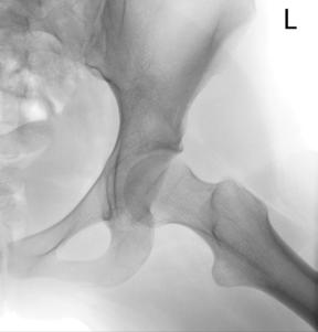 Figura 4