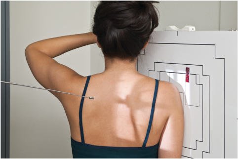 Fig. 5.82). • Dimensiunea câmpului de colimare la aria de interes diagnostic.