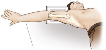 Fig. 5.46 Incidență axială inferosuperioară (metoda Lawrence).