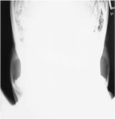 Fig. 11.150 AP axială.