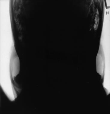 Figura 4