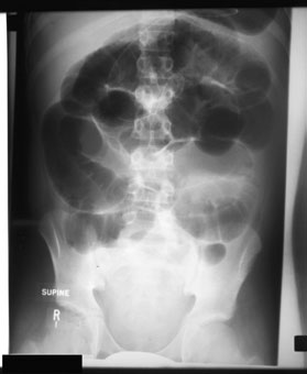 sunt prezentate criterii de trimitere mai specifice pentru radiografiile abdominale