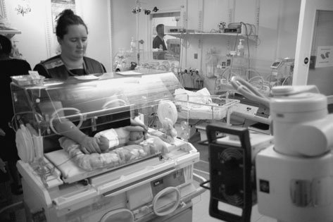 • Radiografia abdominală anteroposterioară (AP) în decubit dorsal este