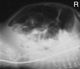 cea descrisă pentru radiografia toracică neonatală în non-