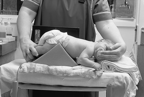 rămână în această poziție câteva minute înainte de efectuarea radiografiei