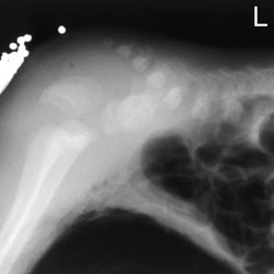 radiografia combinată anteroposterioară (AP) a toracelui și abdomenului este