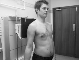 Radiografie anteroposterioară (AP) a