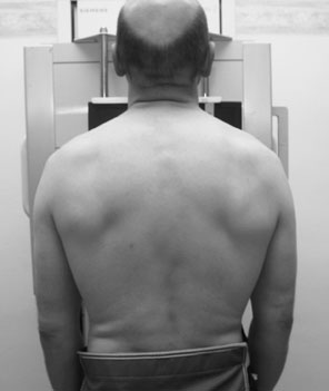 • Expunerea radiografică este similară celei utilizate pentru o