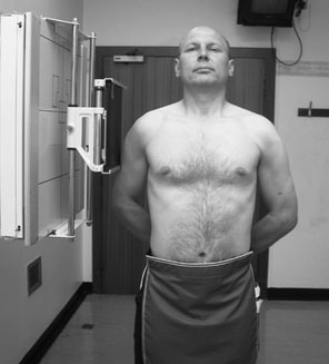 Radiografie normală a articulațiilor sternoclaviculare în incidență de profil (lateral)