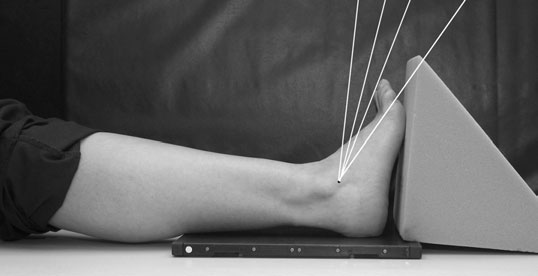 radiografie care evidențiază efectul angulației de 40°
