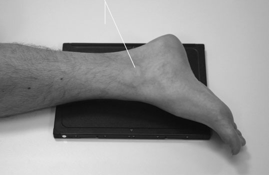 radiografie a articulațiilor subtalare — incidență oblică, profil (lateral)
