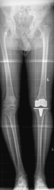 poziție pentru a permite radiografia cu fascicul orizontal utilizând o DFF mare,