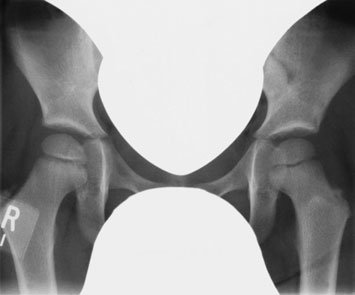 Radiografia poate fi efectuată înaintea sau în timpul tratamentului,