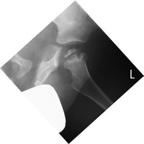Figura 4: Aspect radiografic / Poziționare (Clark Ed. 12)