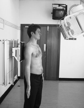 Radiografie antero-posterioară (AP) a umărului cu 25 de grade caudal