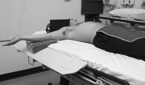 Radiografie infero-superioară (axială) a umărului, evidențiind calcificările patologice