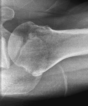 Figura 4: Aspect radiografic / Poziționare (Clark Ed. 12)